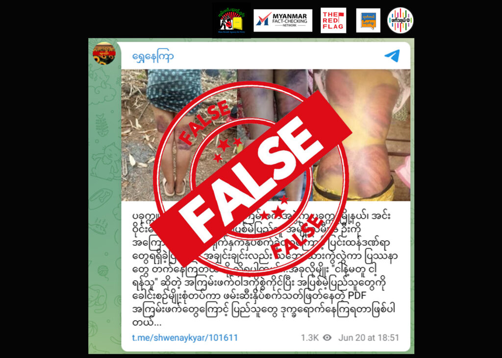 CDM သူနာပြု အမျိုးသမီးရဲဘော်တယောက်ကို PDF တပ်ရင်းမှူးက လူ့အခွင့်အရေးချိုးဖောက်နှိပ်စက်တဲ့ပုံကို အသုံးပြုပြီး ပခုက္ကူ PDF တပ်ရင်း(၈)က ဒေသခံအပြစ်မဲ့ပြည်သူ အမျိုးသမီး ၆ ဦးကို ရိုက်နှက်ဆိုပြီး စစ်ကောင်စီလော်ဘီ များ ဝါဒဖြန့်ချိ